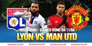 Lyon Vs MU, 02h00 Ngày 11/4: Cái Duyên Trước Người Pháp